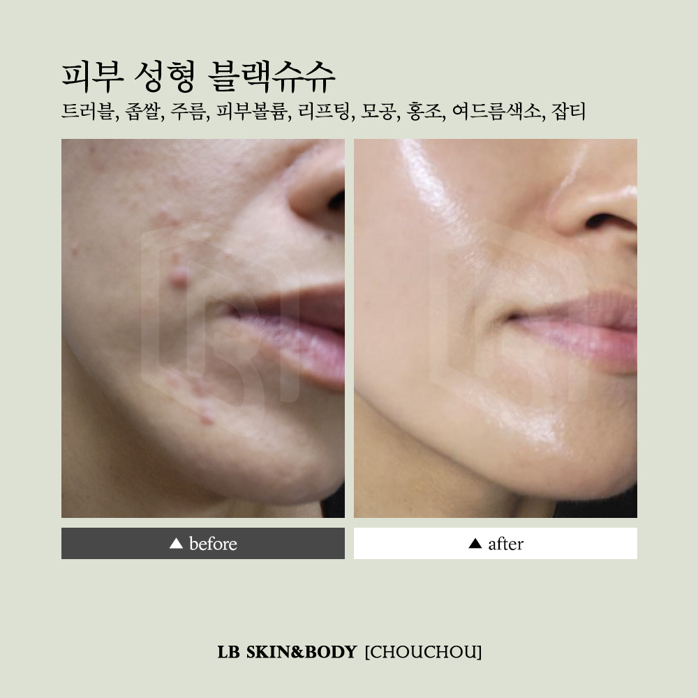 엘비스킨앤바디 대표 이미지