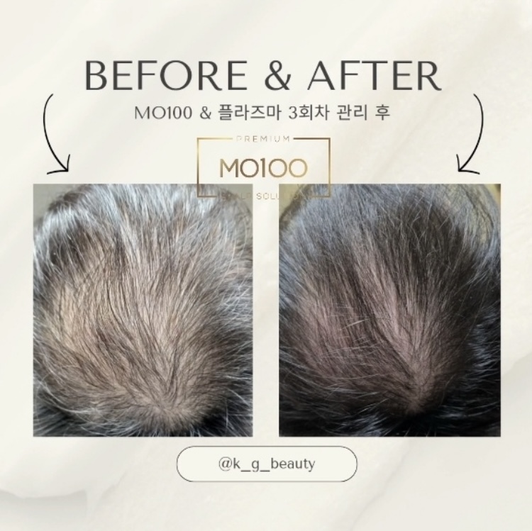 진헤어