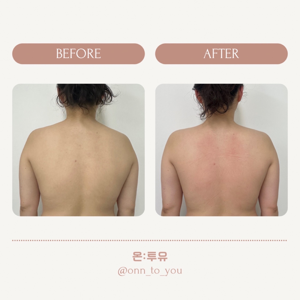 온투유 photo 10