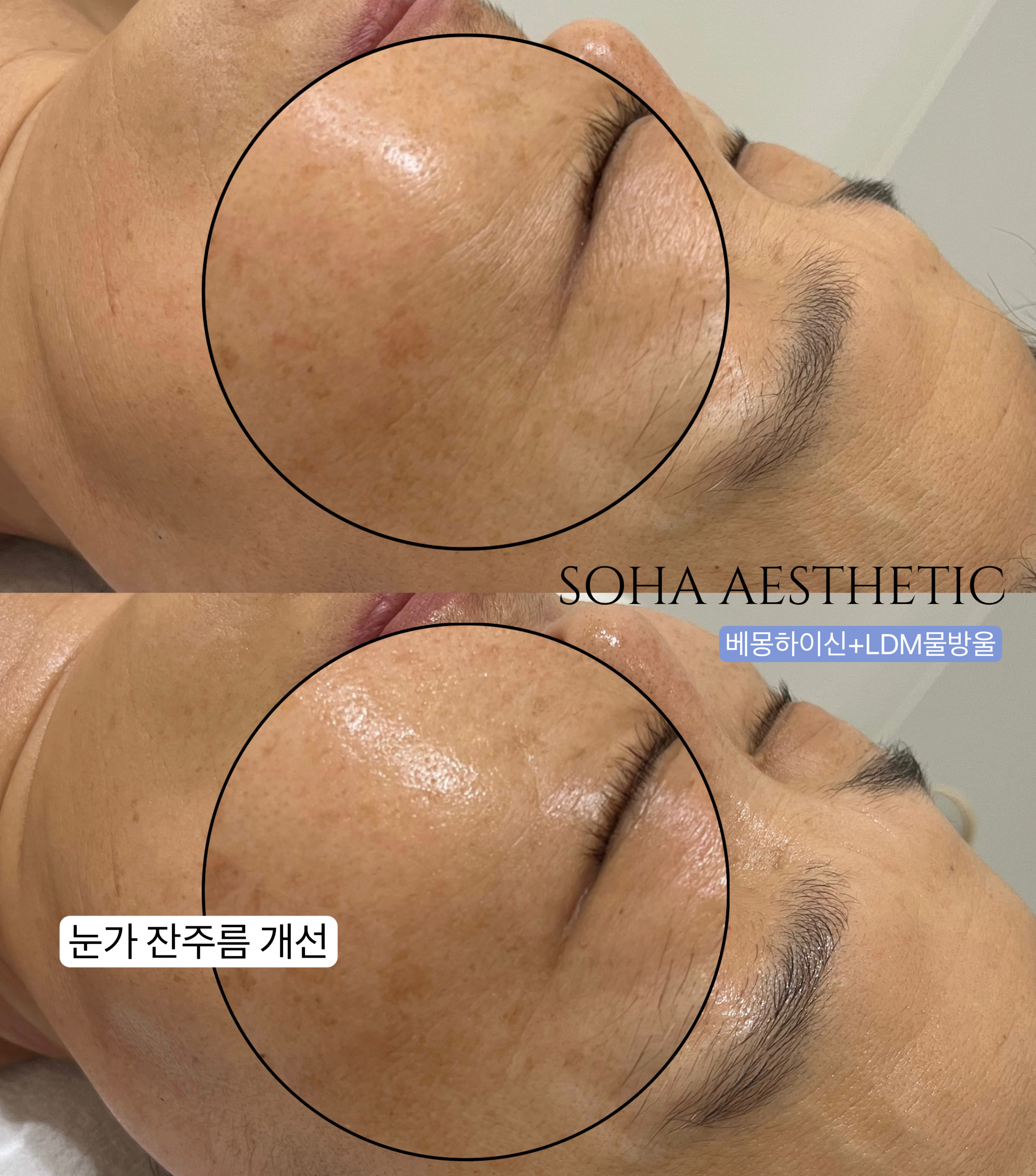 소하에스테틱 나주혁신점 대표 이미지