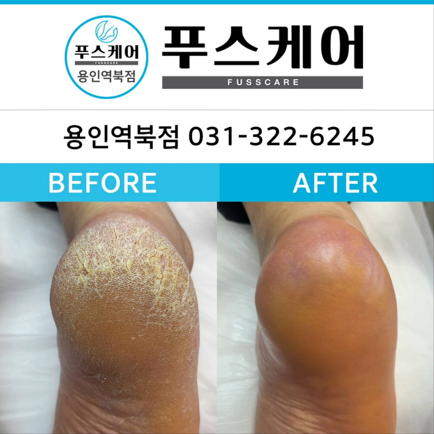 푸스케어 용인역북점