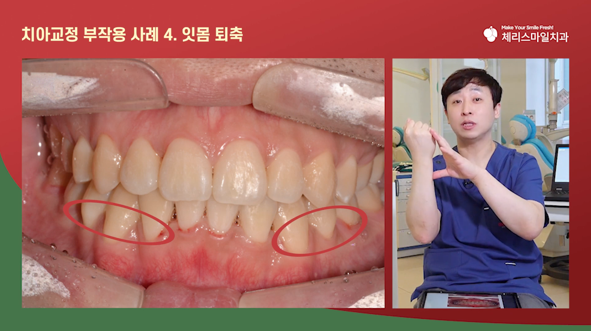 체리스마일치과의원