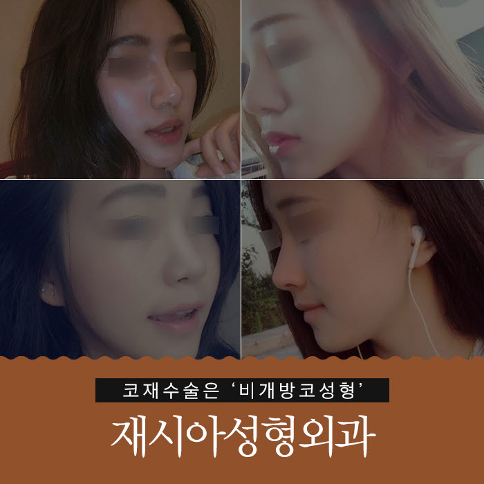 재시아성형외과의원 대표 이미지