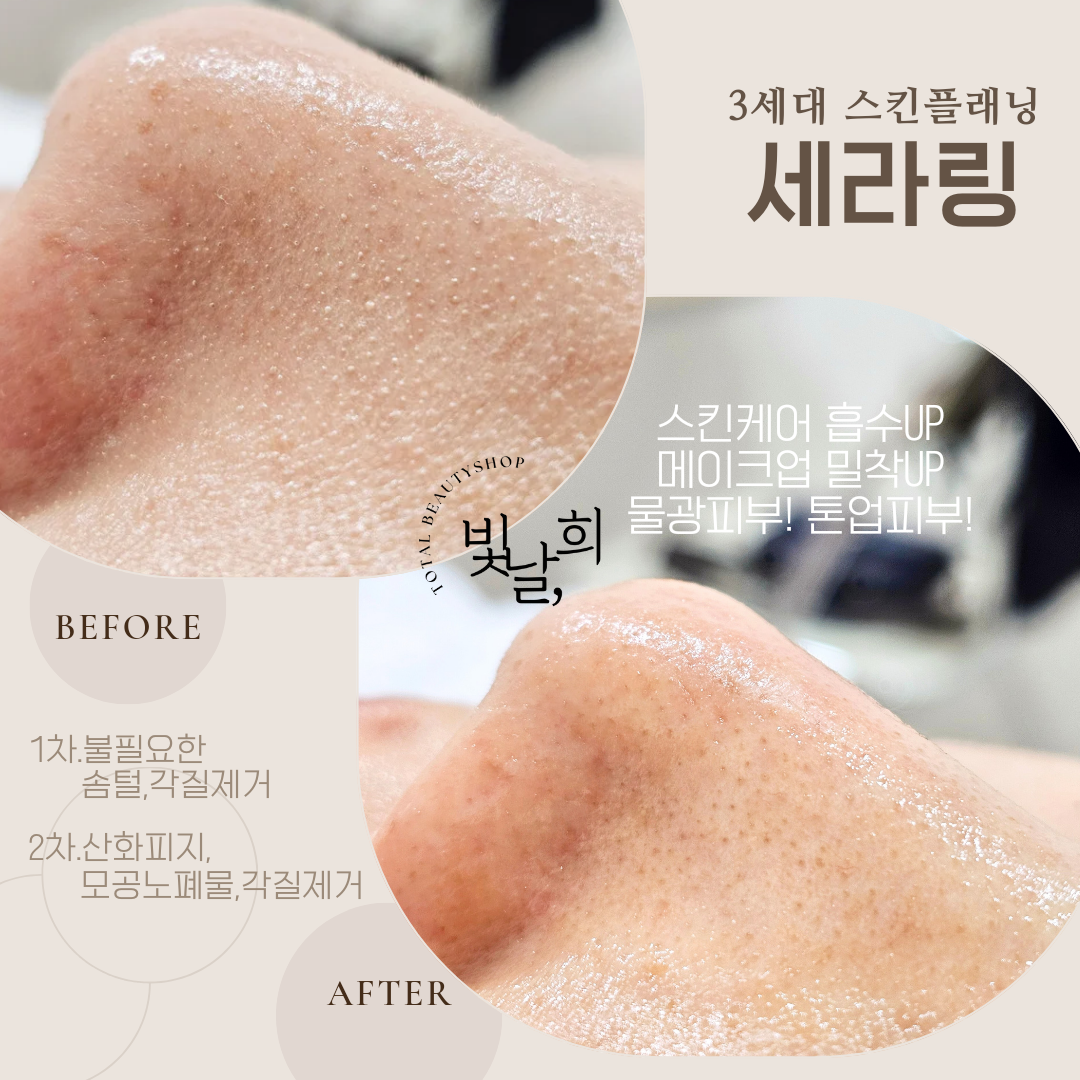 빛날희뷰티