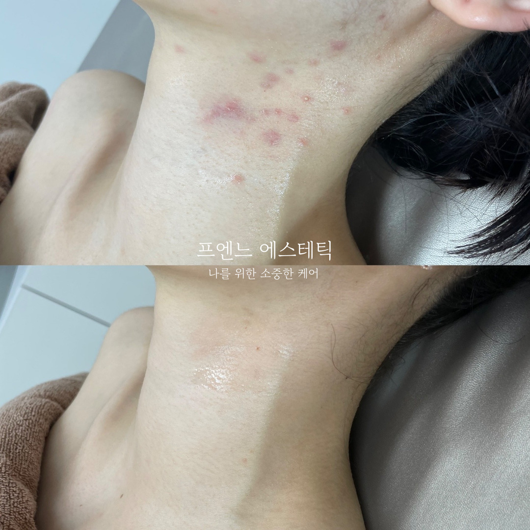 라온제이 에스테틱
