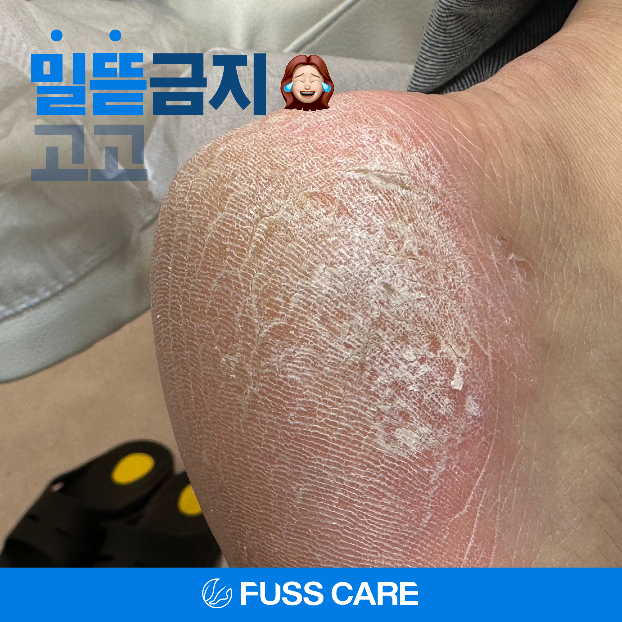 푸스케어 대표 이미지