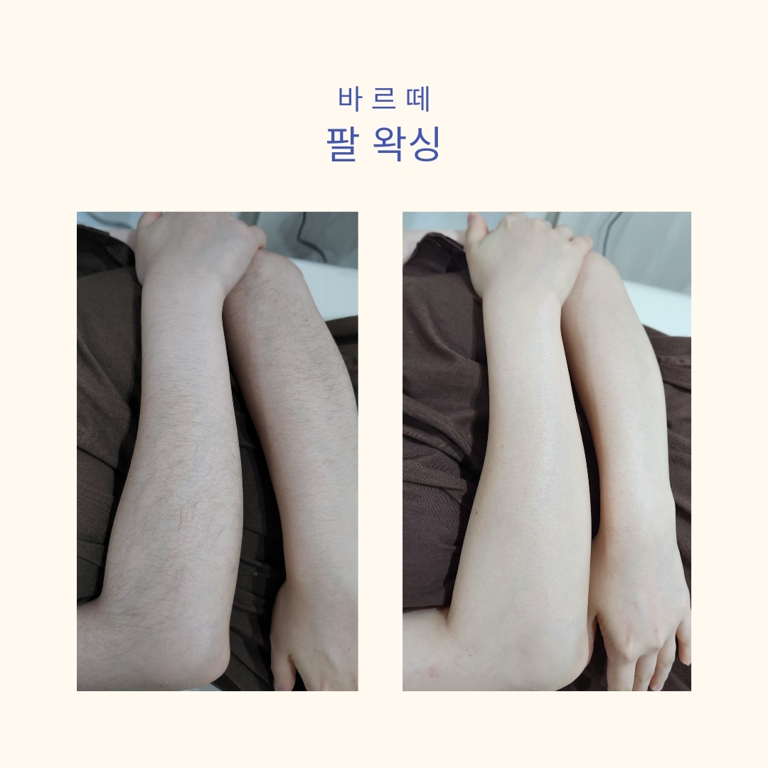 바르떼 슈가링왁싱 대표 이미지