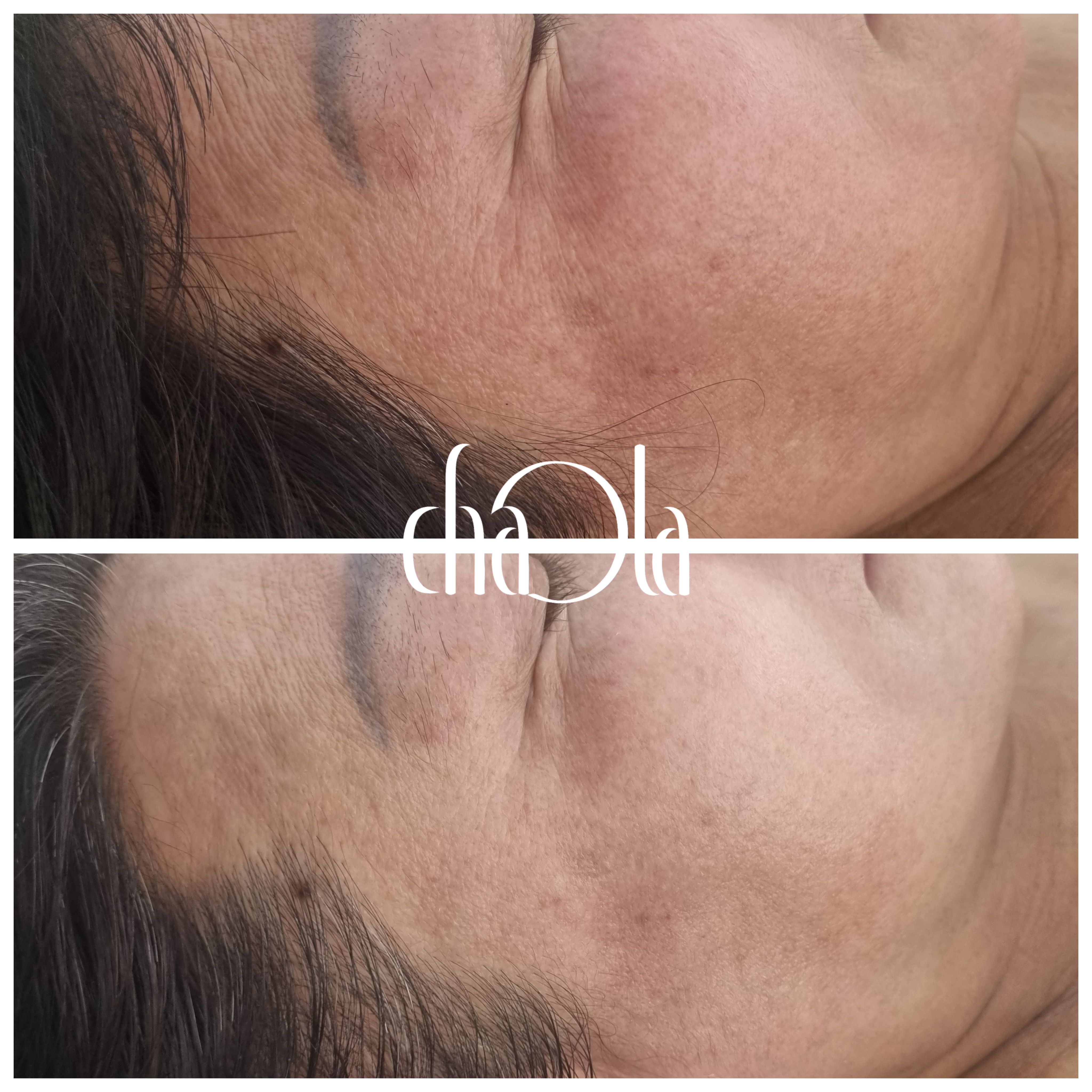 차올라메디스킨 대표 이미지