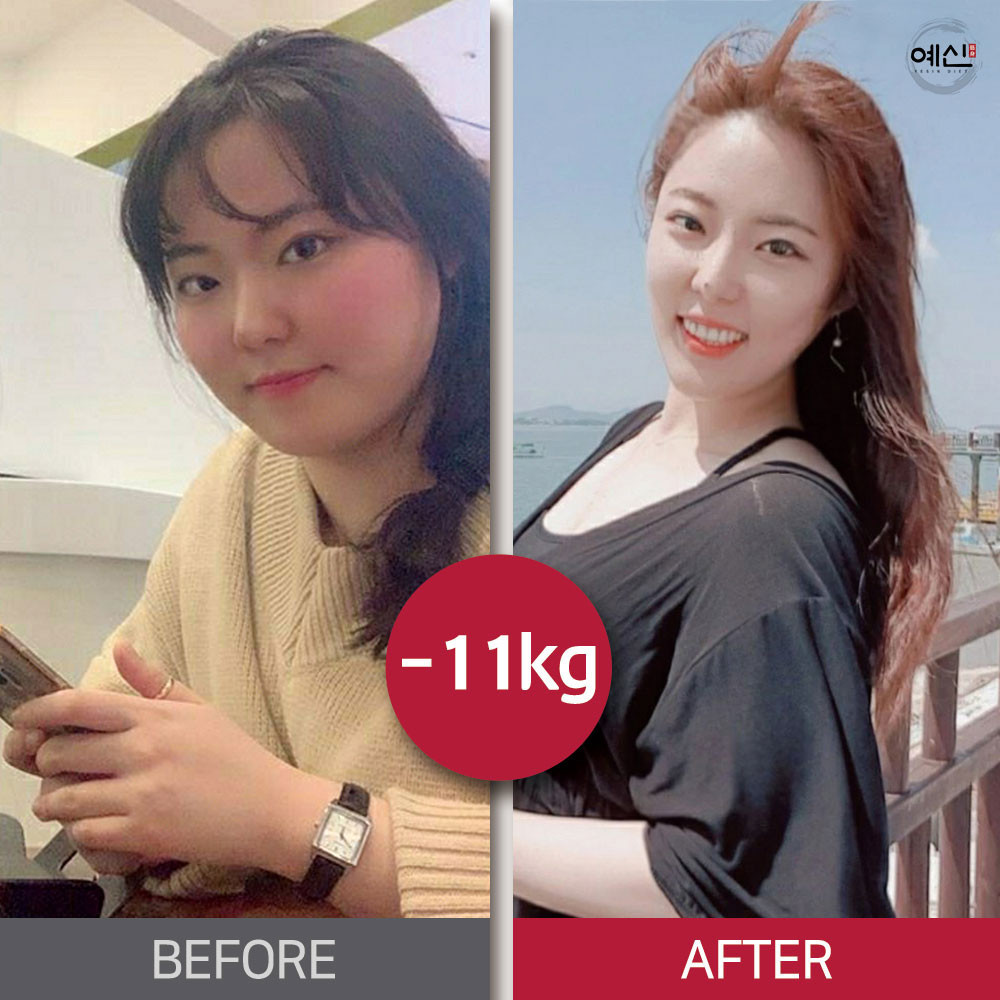 예신 송파점 대표 이미지