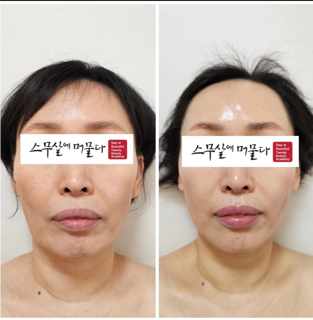 스무살에머물다 대구대명점 대표 이미지
