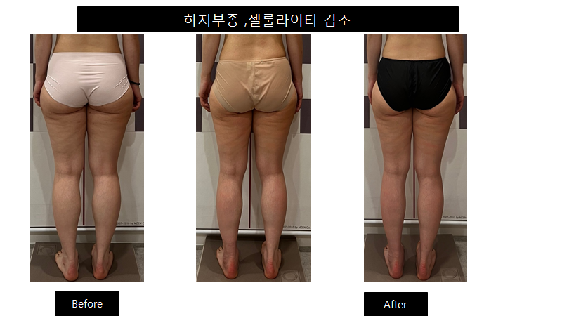 모비연