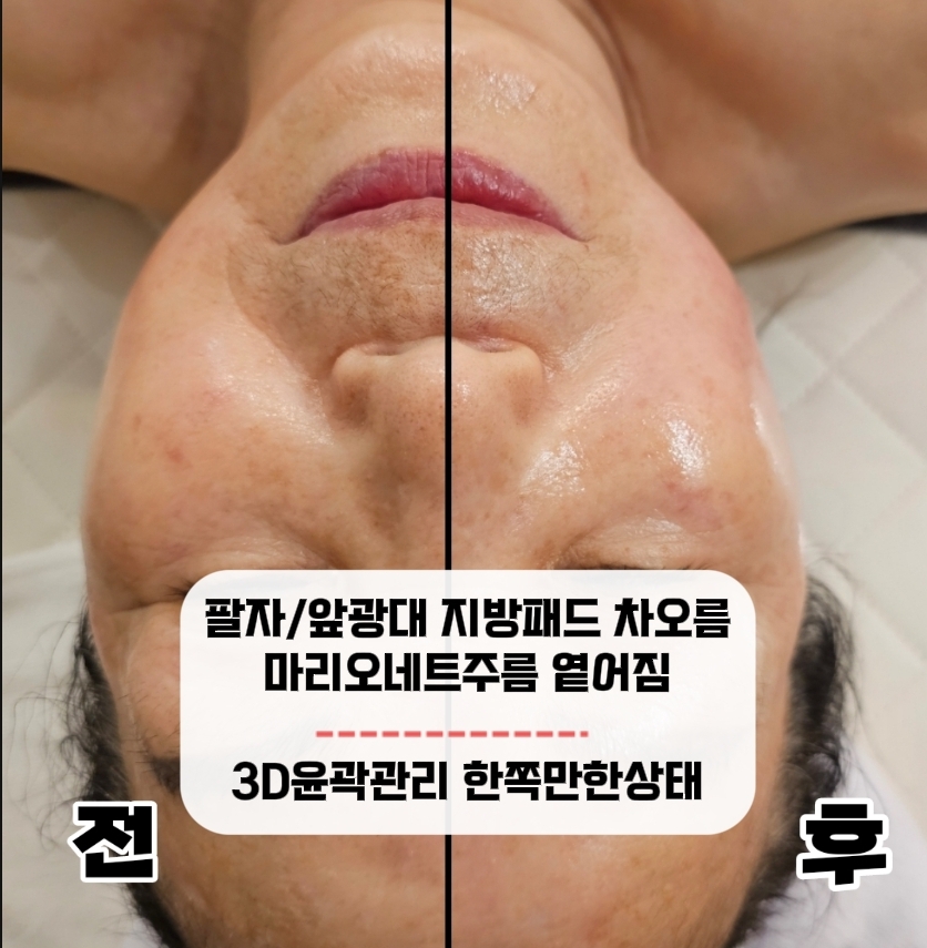 스무살에머물다 대표 이미지