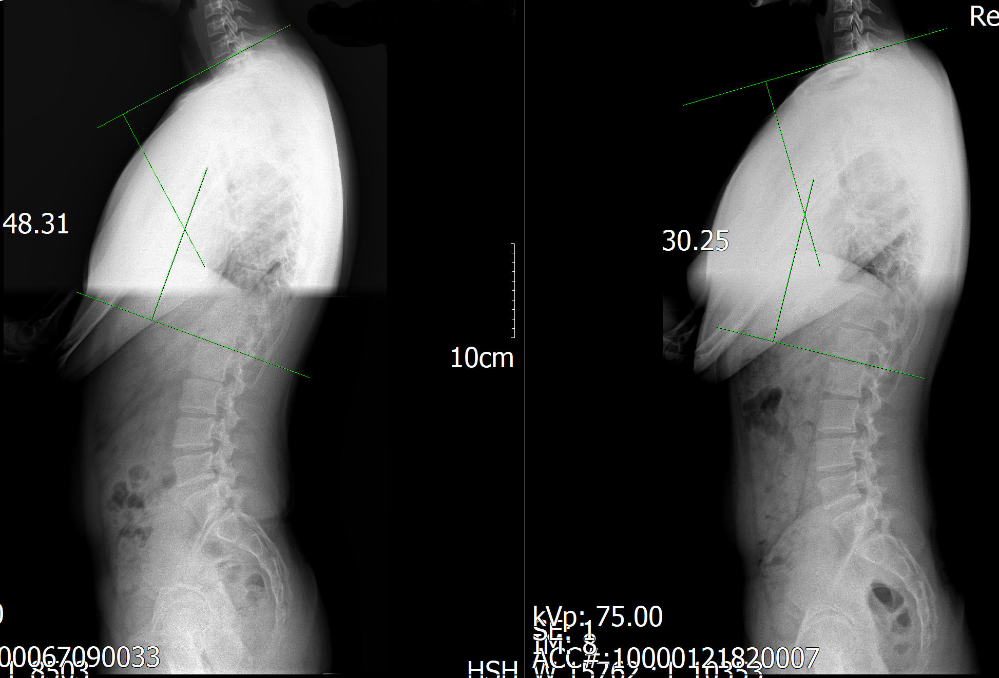자세체형교정센터밸런스핏 대표 이미지
