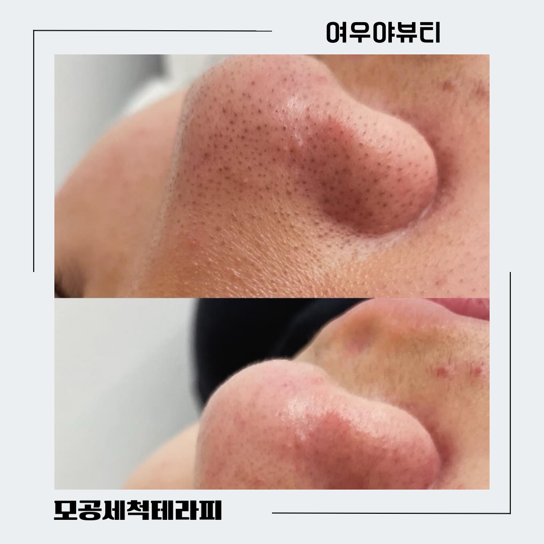 여우야 뷰티 원주점