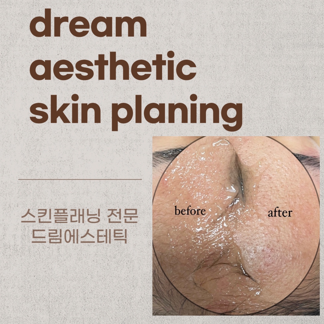 드림에스테틱 광명하안점