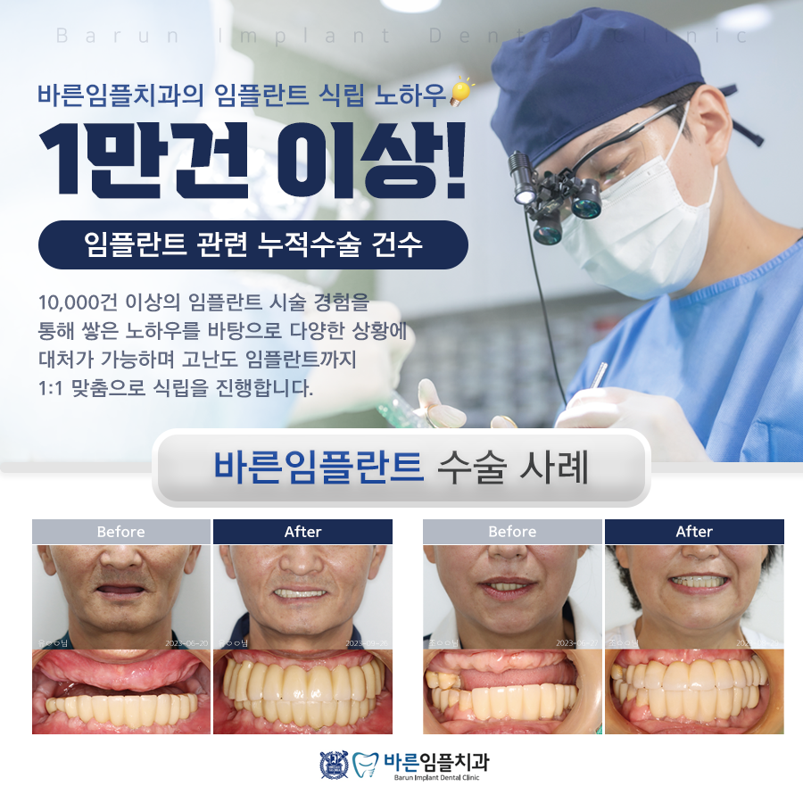바른임플치과의원 노원점 대표 이미지