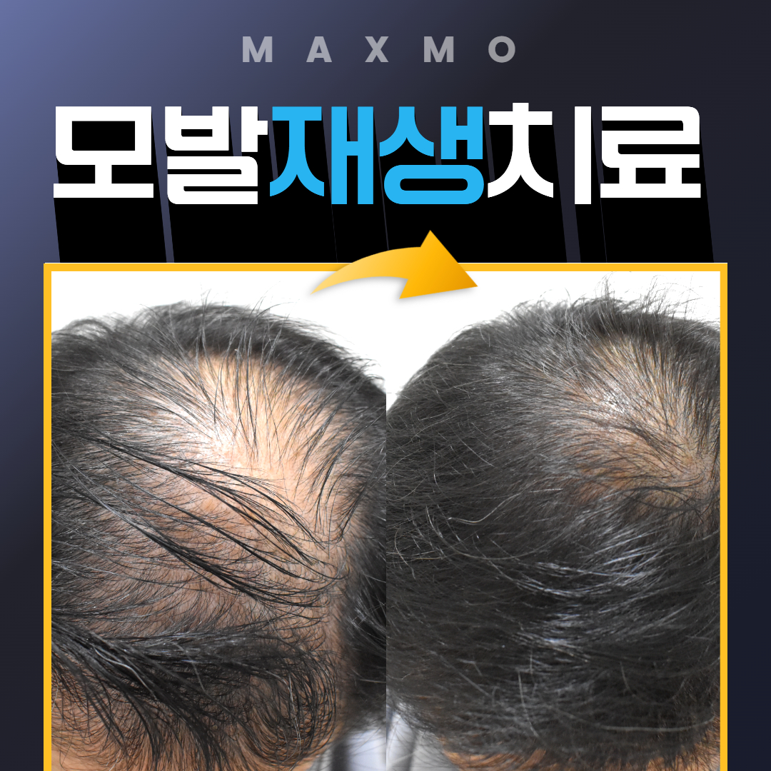 맥스모외과 대표 이미지