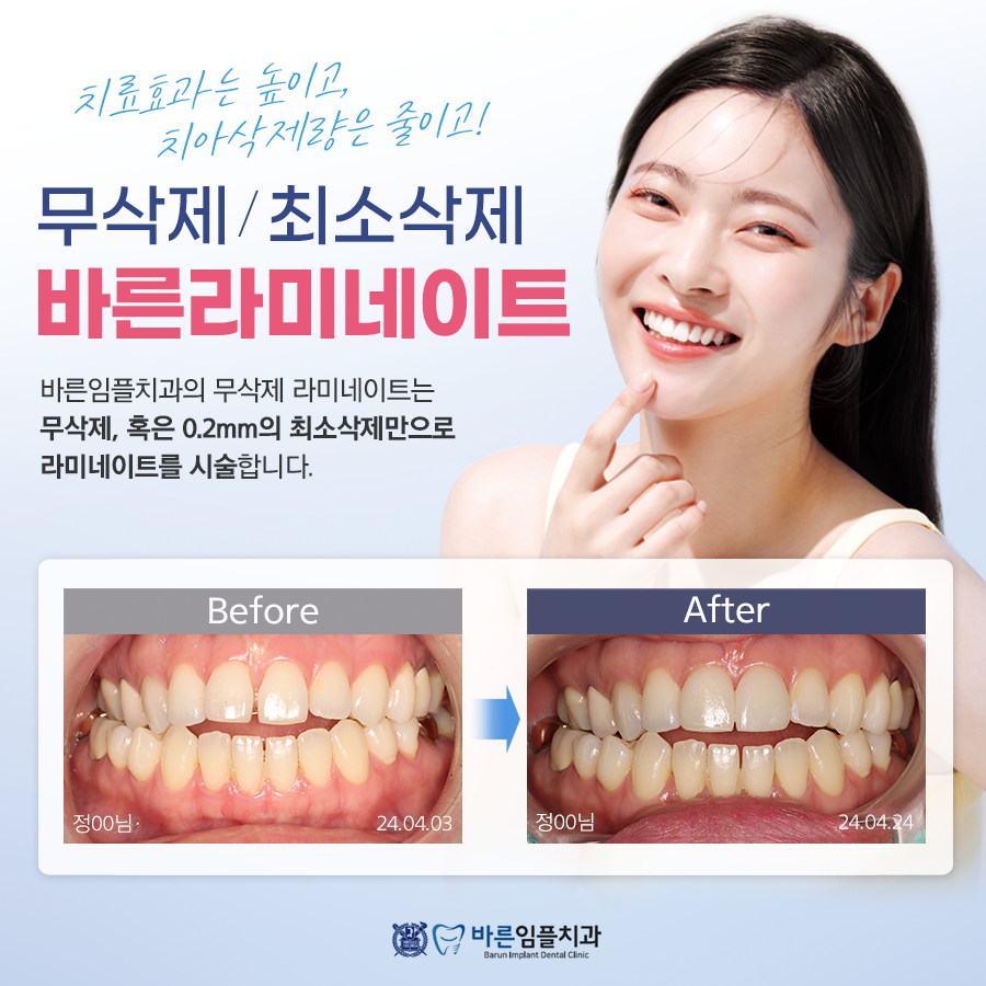 바른임플치과의원 노원점 대표 이미지