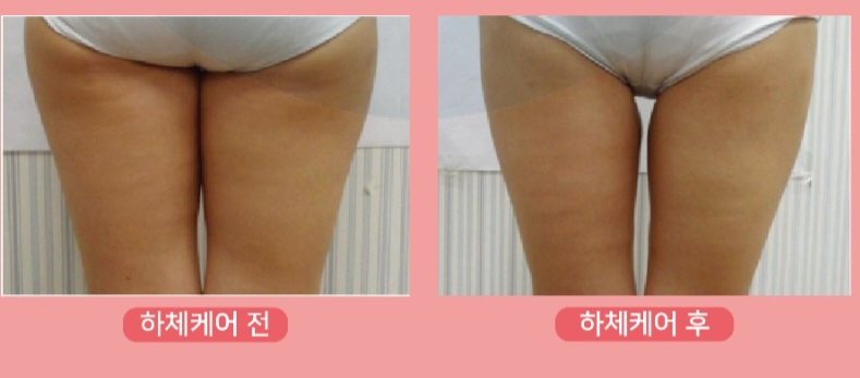 더어려지다에스테틱