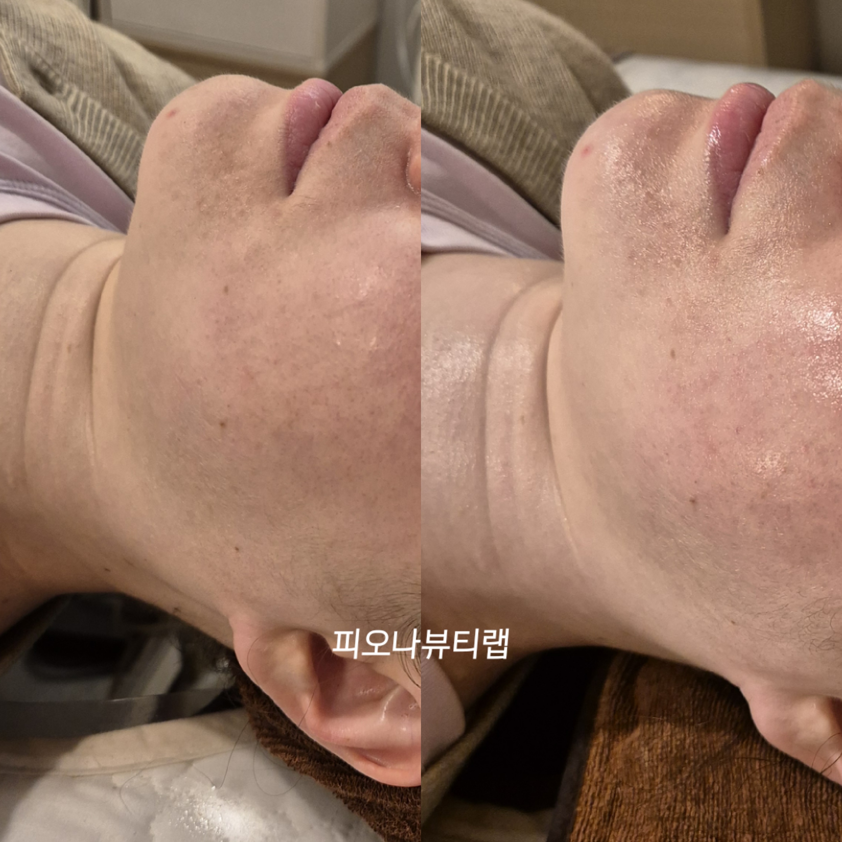피오나뷰티랩 photo 8