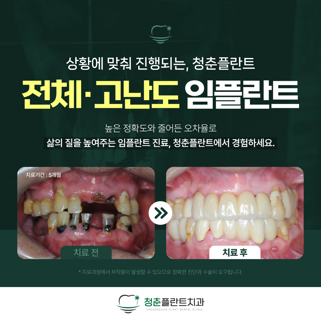 청춘플란트치과 대표 이미지