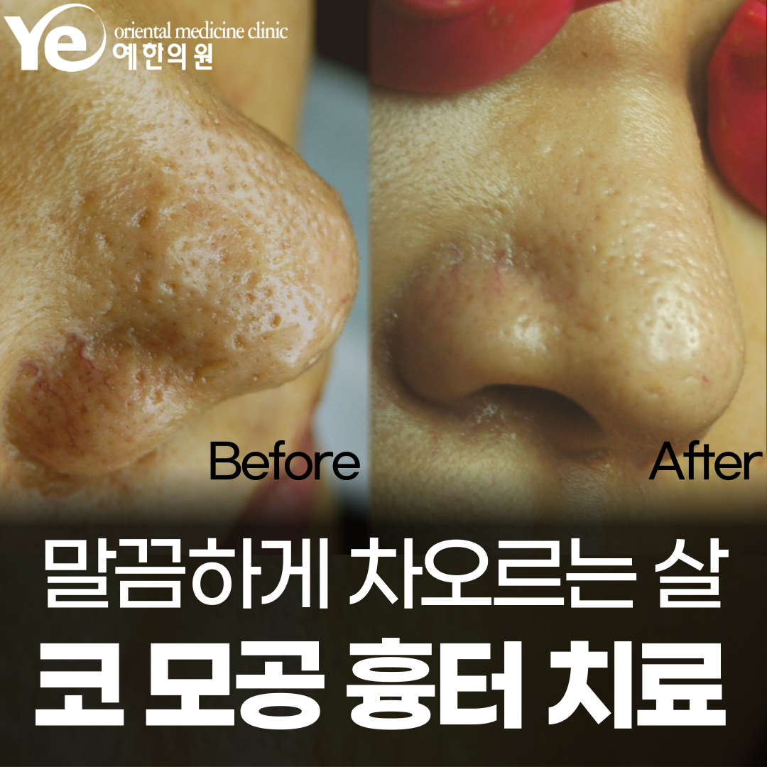 예한의원 대표 이미지