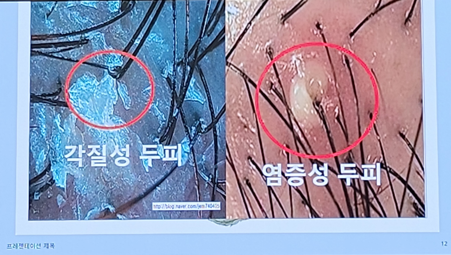 큐사랑 수지신봉점