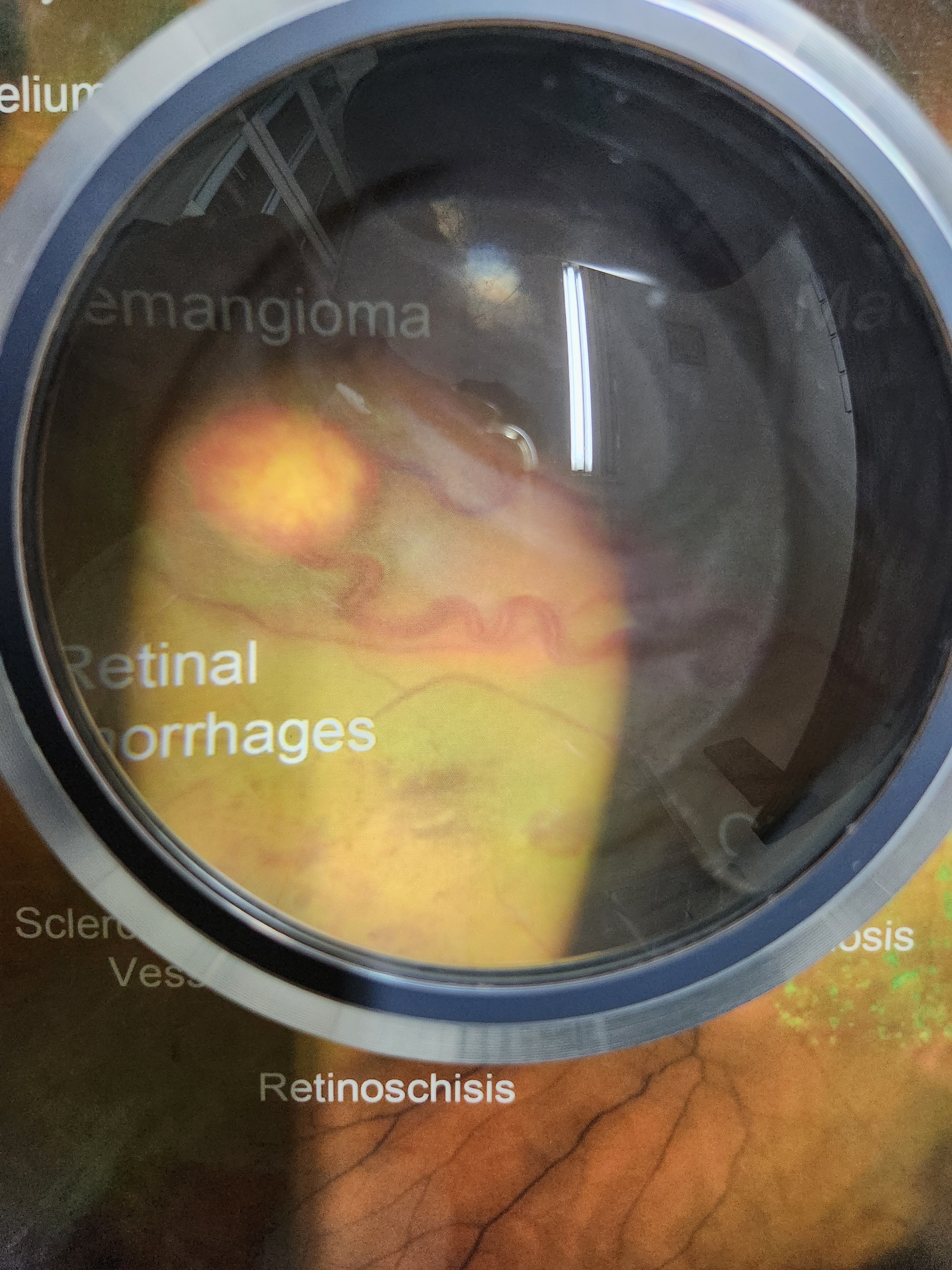 안혁안과의원 대표 이미지