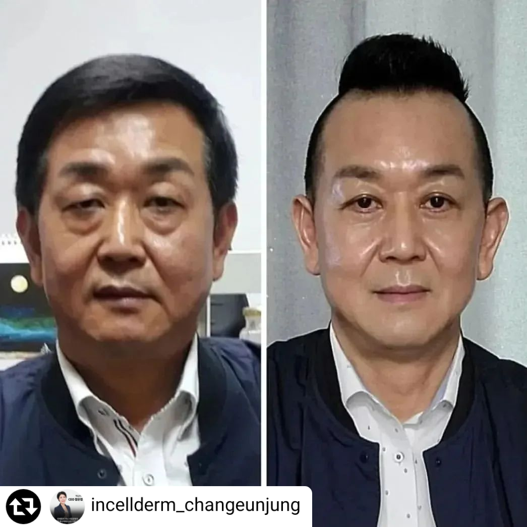 뷰티다희인셀덤