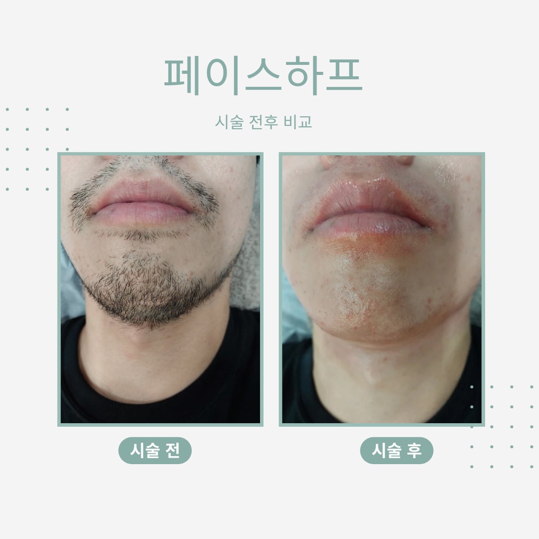 아나덴 슈가링왁싱 광주충장로점