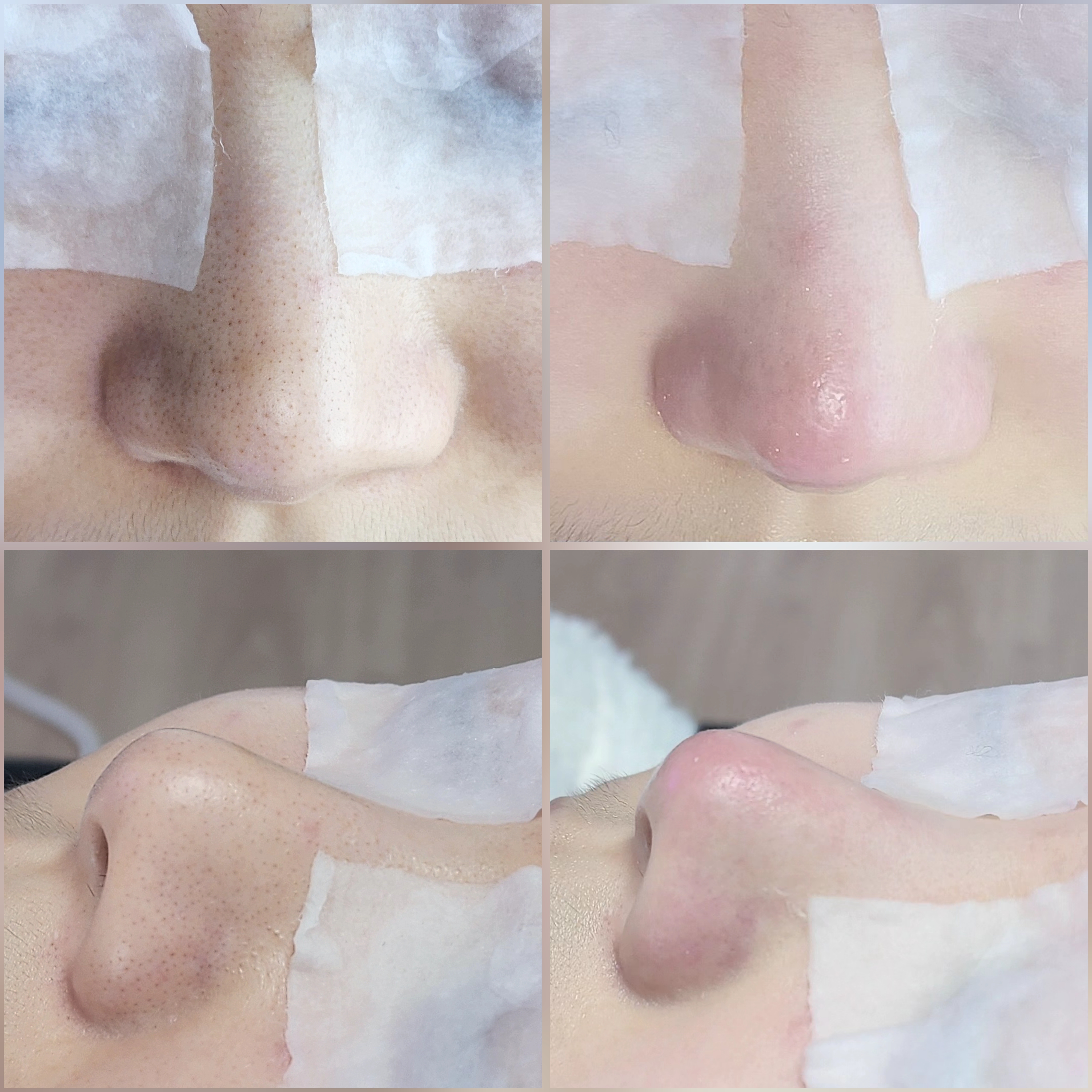 블랙헤드 코피다 수원점 대표 이미지