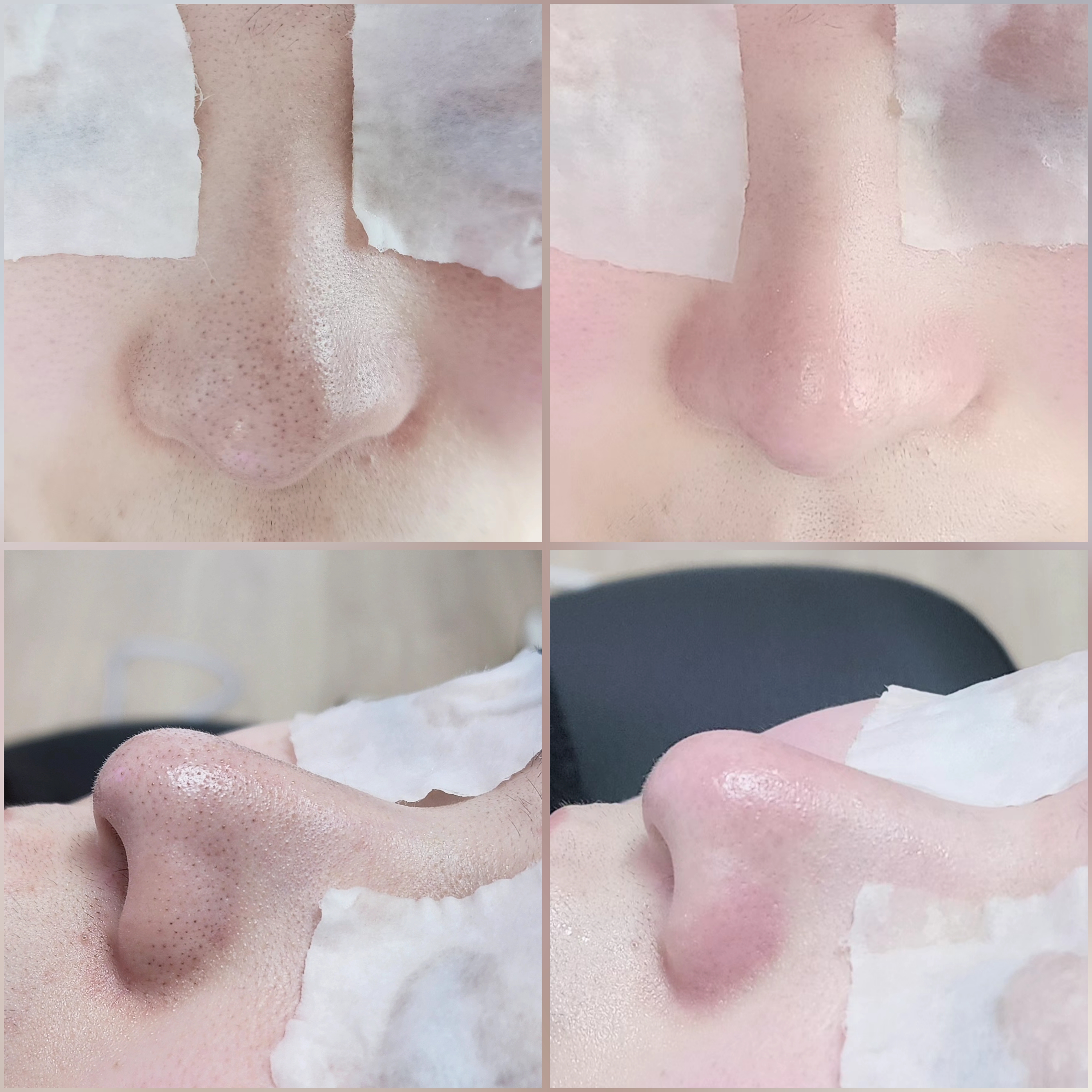 블랙헤드 코피다 수원점 대표 이미지