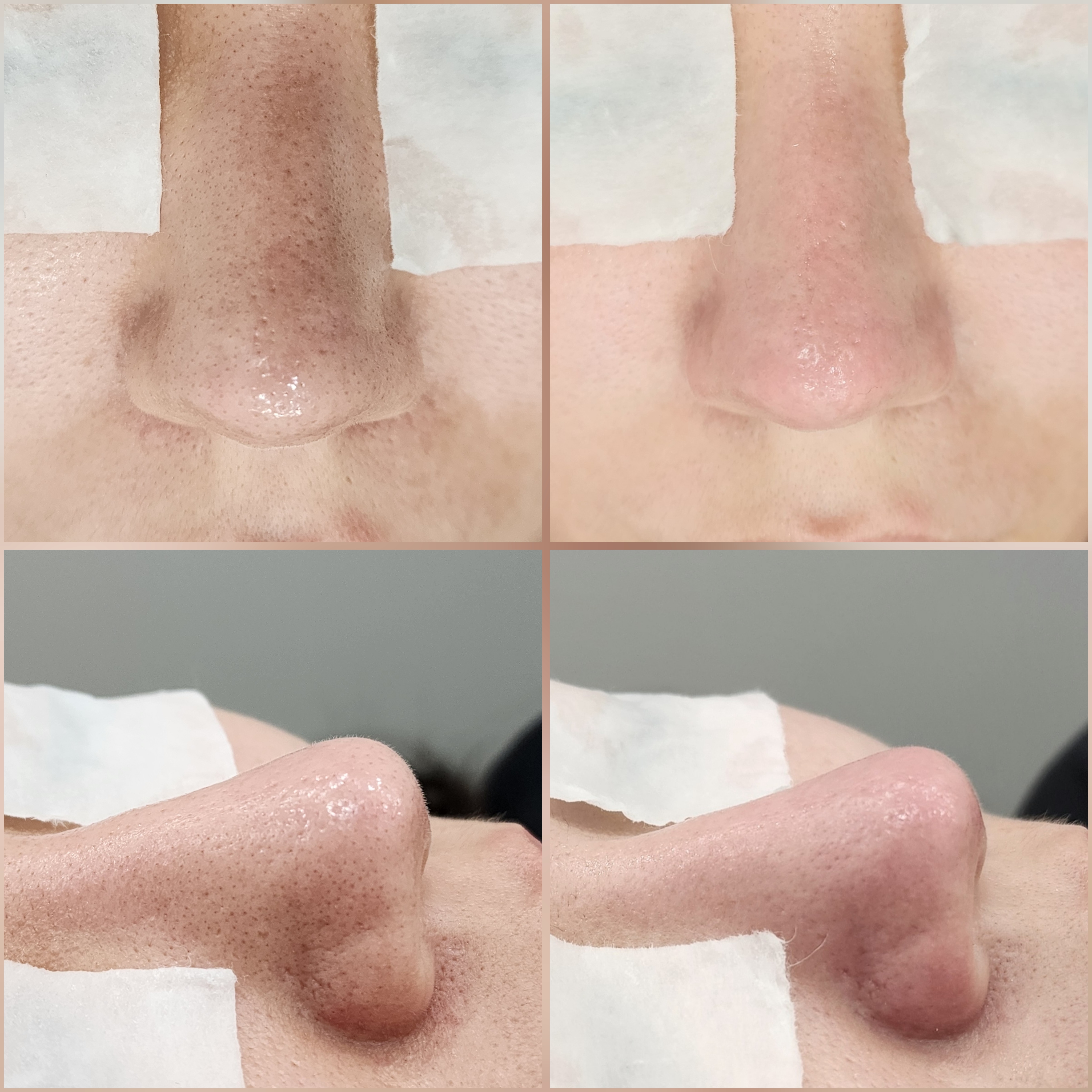 블랙헤드 코피다 수원점 대표 이미지