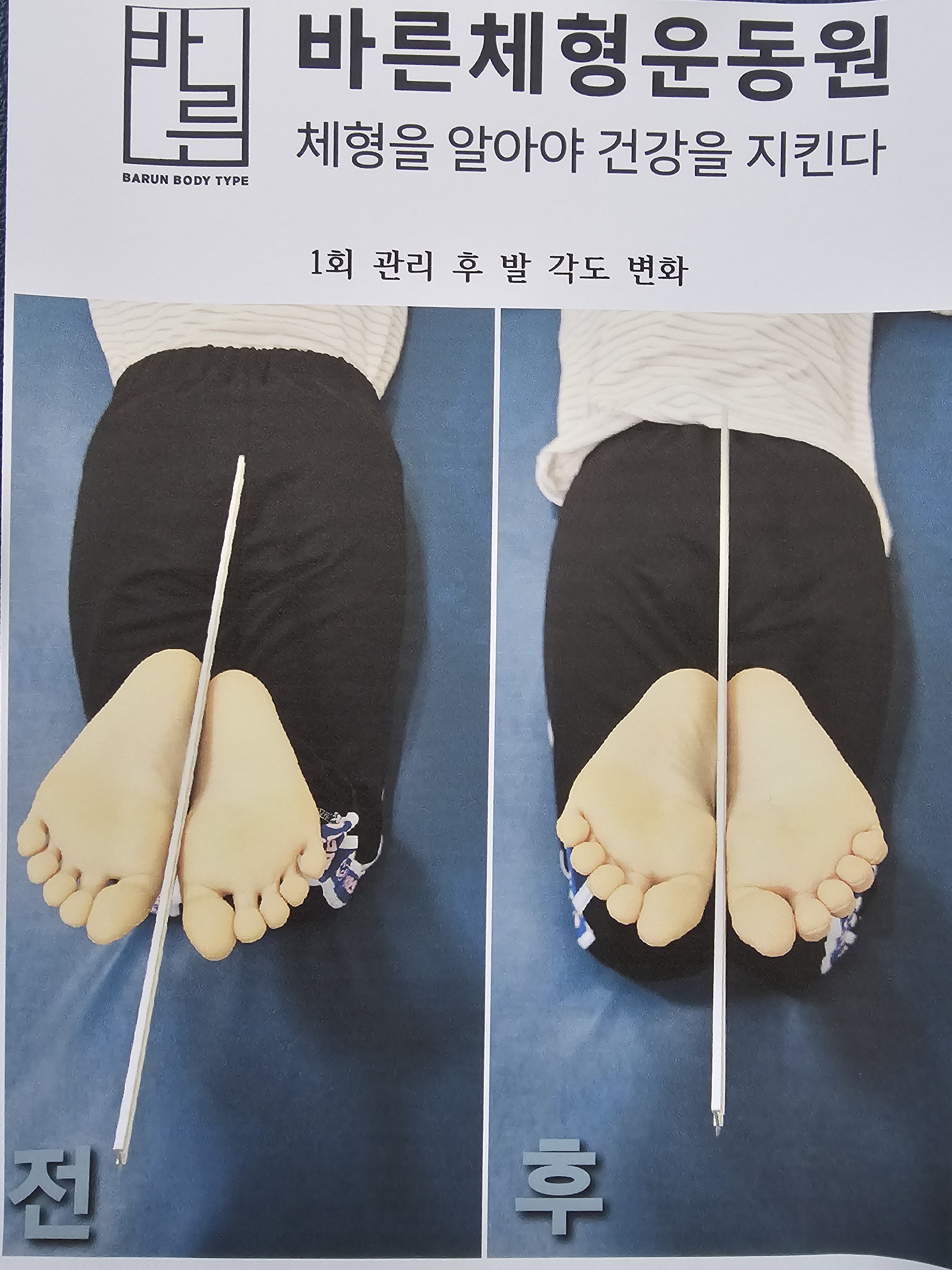 바른체형운동원