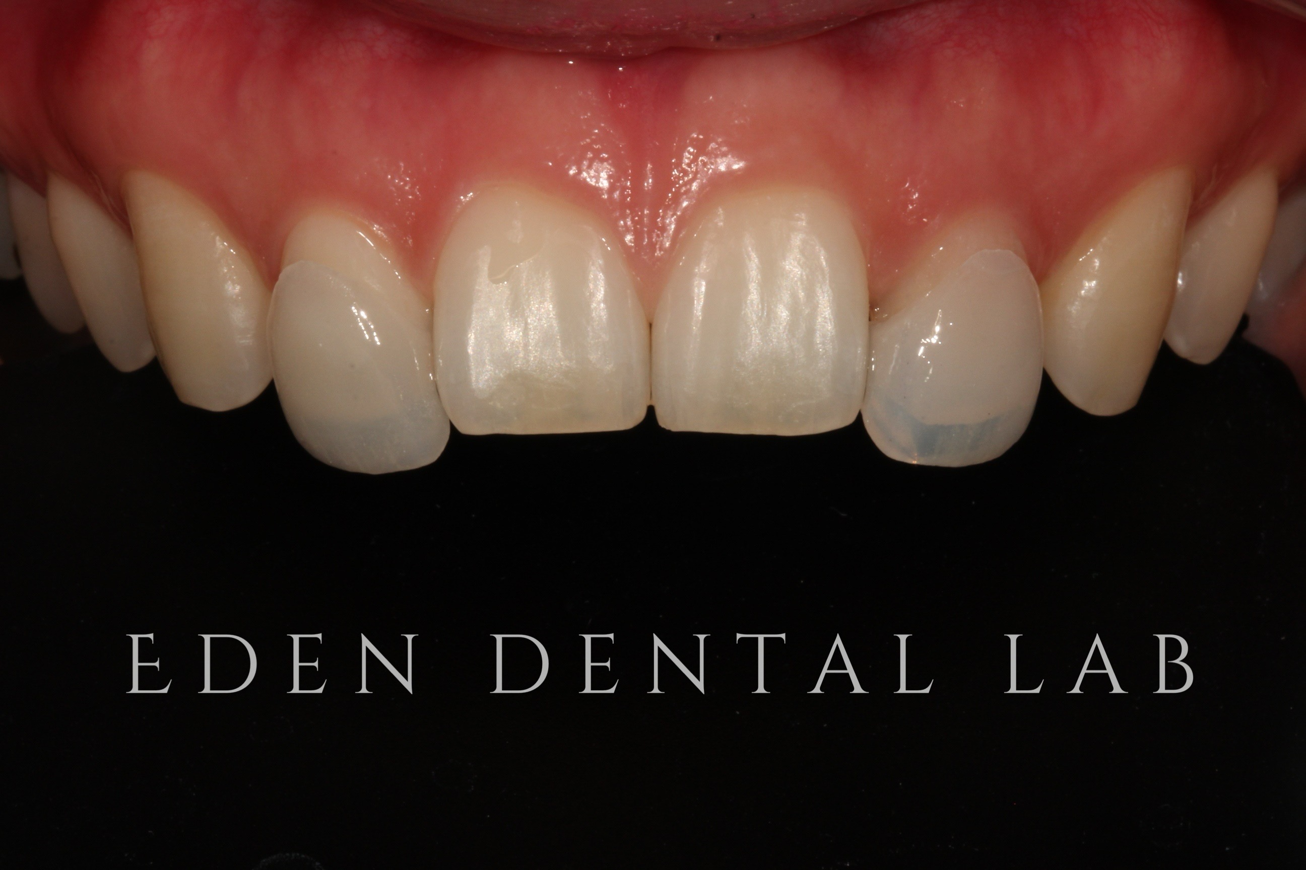 에덴치과기공소 대표 이미지