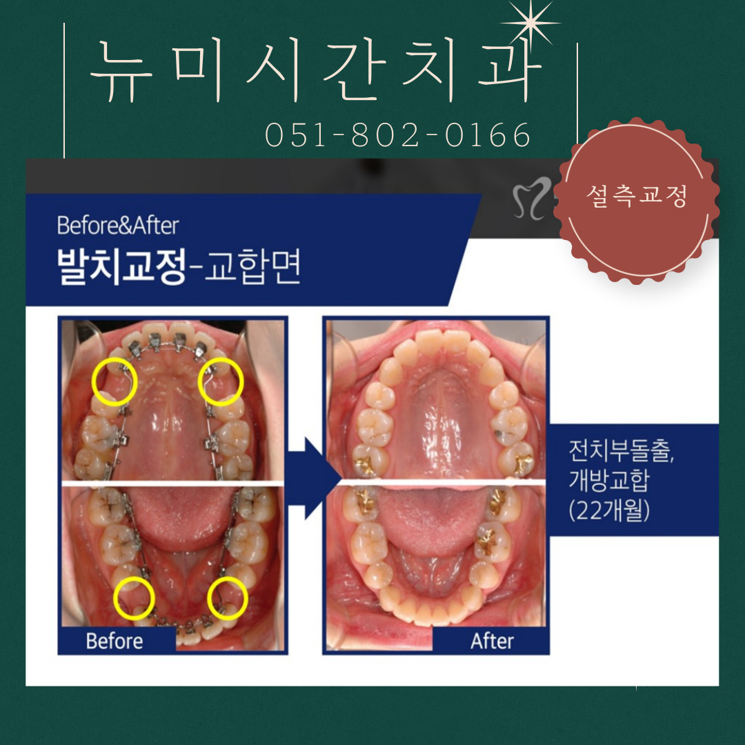 뉴미시간치과의원 대표 이미지