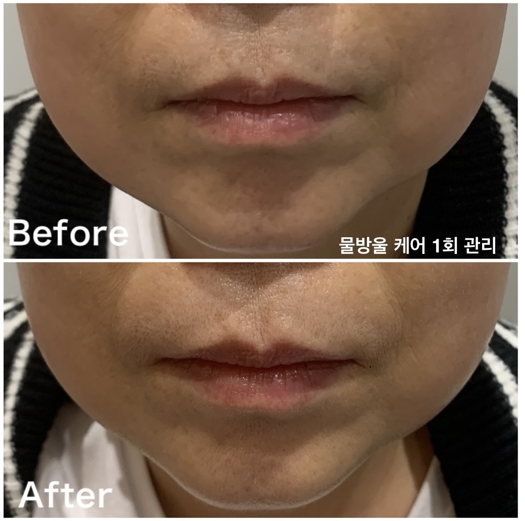 하루앤유 스킨케어 내부 이미지