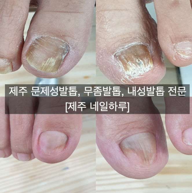 네일하루 대표 이미지