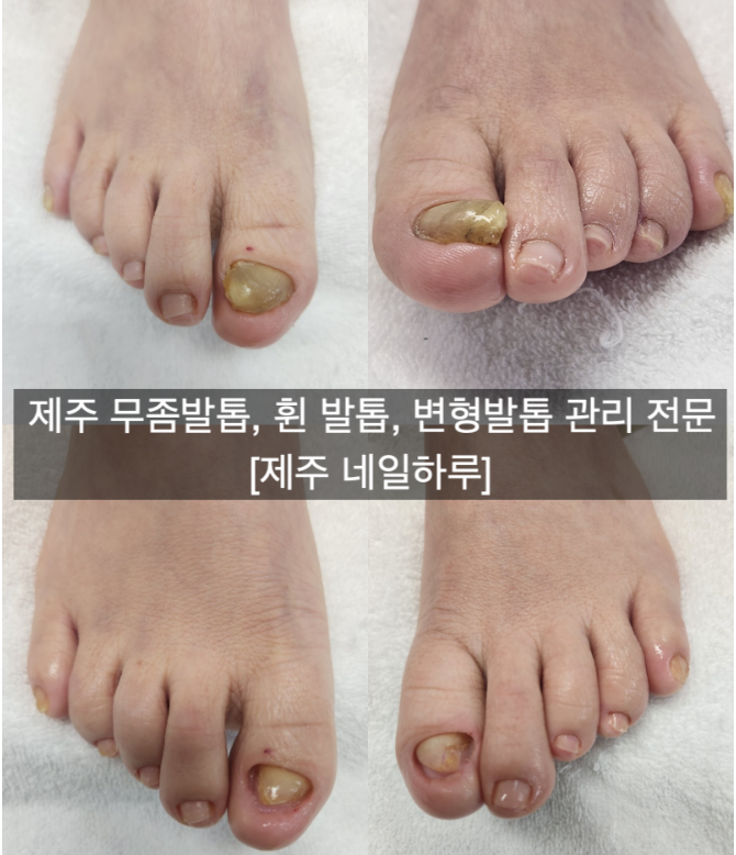 네일하루 대표 이미지