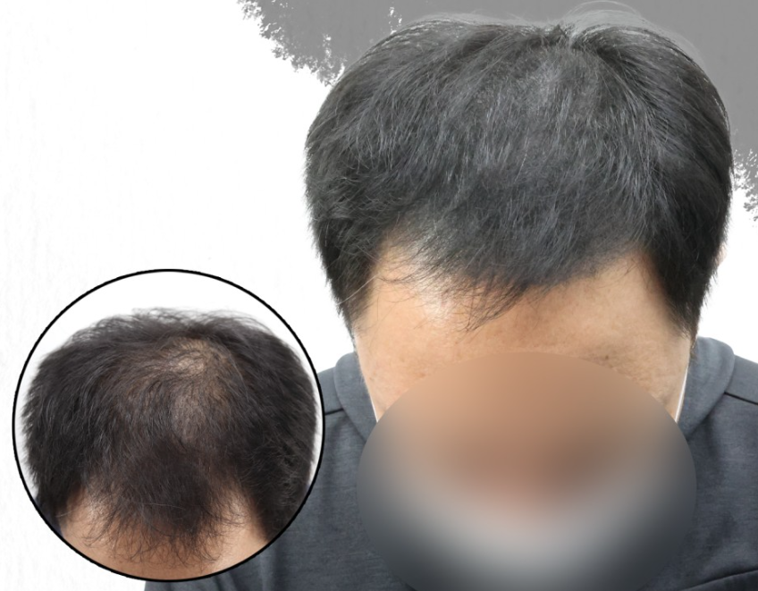 살롱드다온