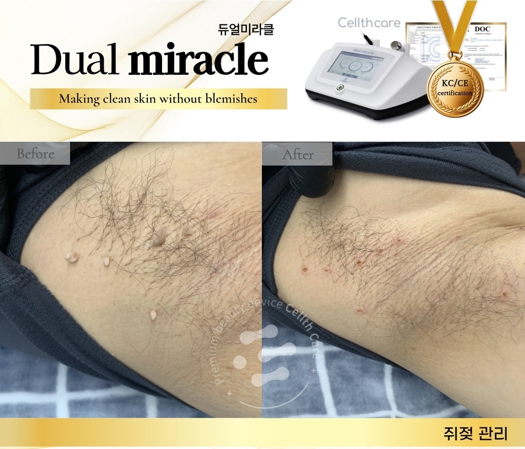 엔라인&풀닷 photo 2