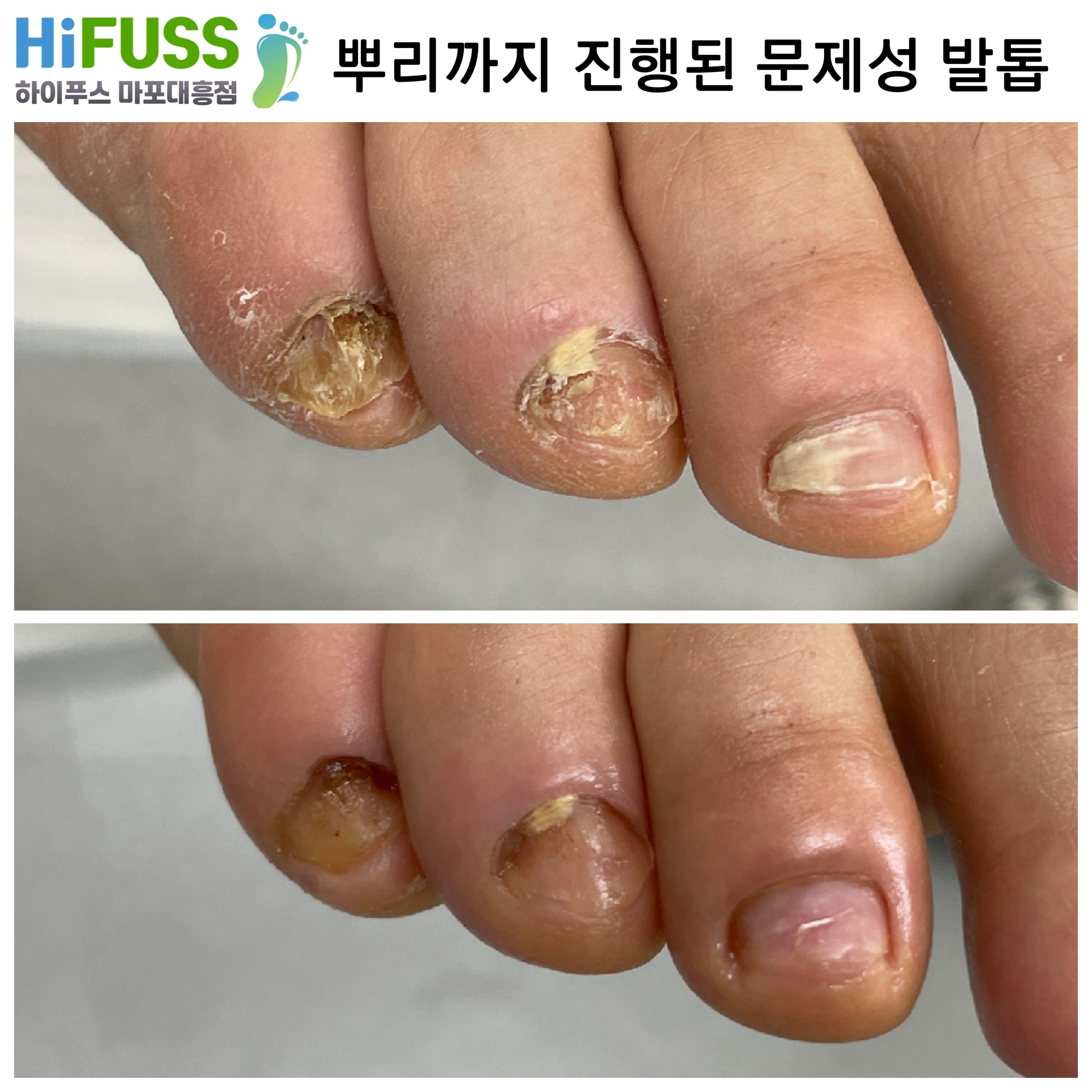 하이푸스 마포대흥점