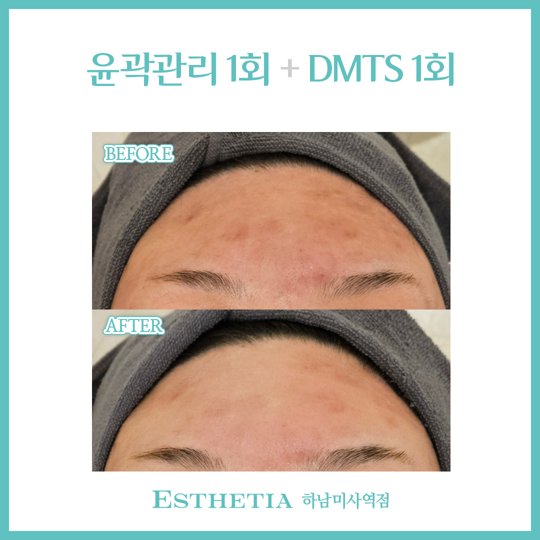 에스테티아 하남미사역점
