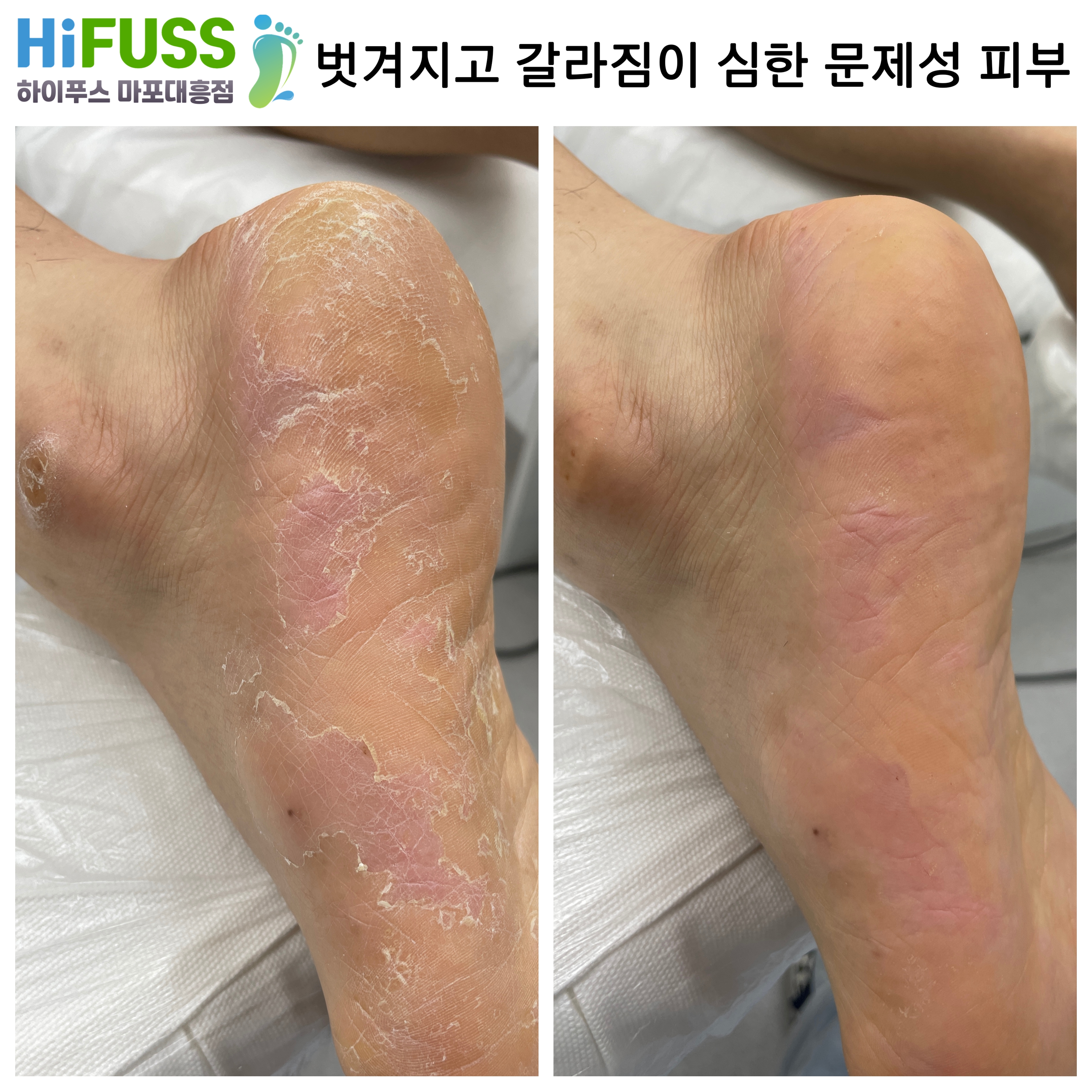 하이푸스 마포대흥점
