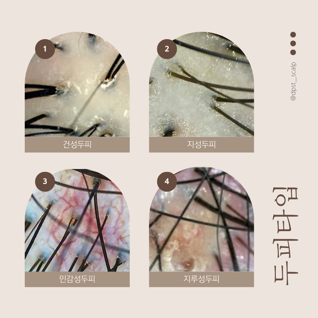두피쉼터