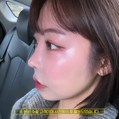 에스클래스성형외과의원 대표 이미지