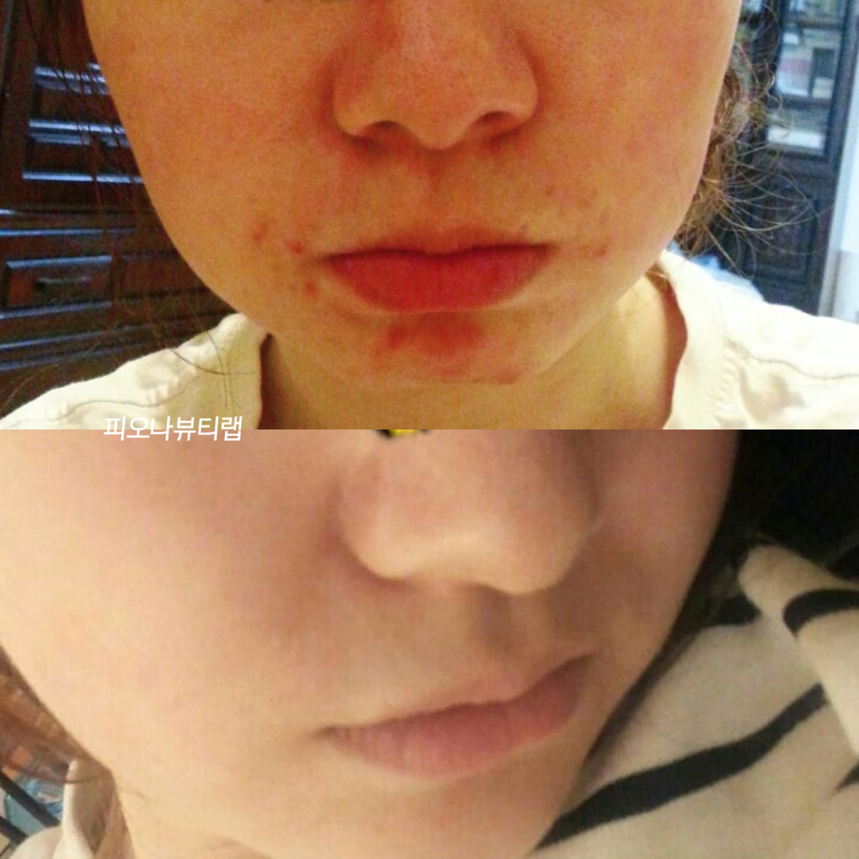 피오나뷰티랩 photo 9
