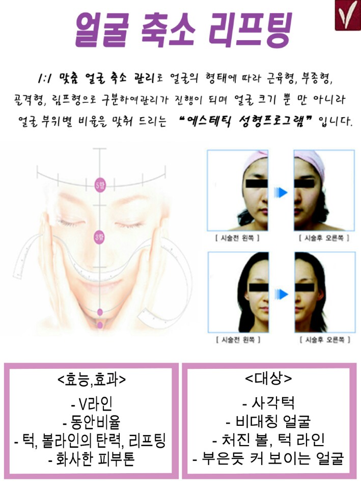 SR뷰티케어 대표 이미지