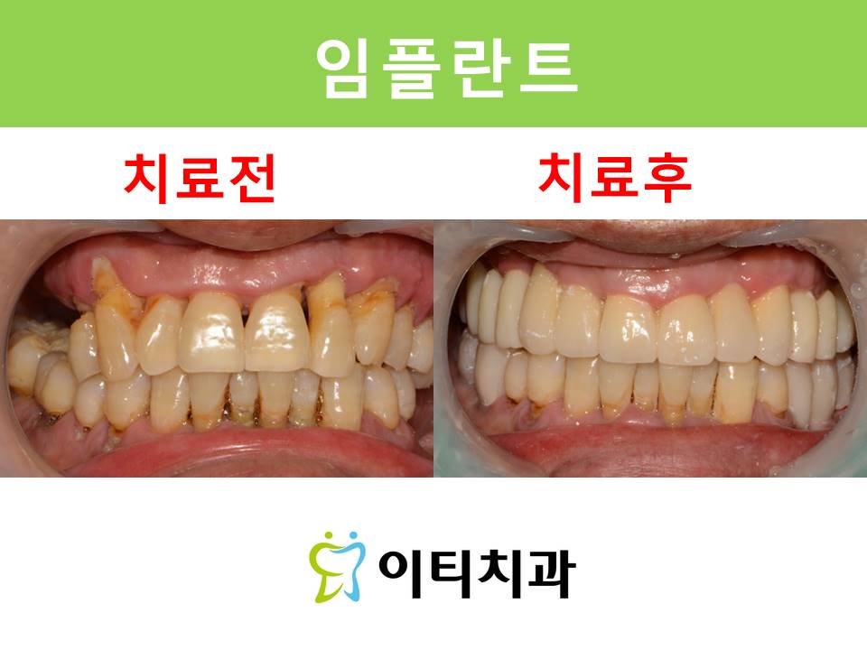 이티치과의원 대표 이미지