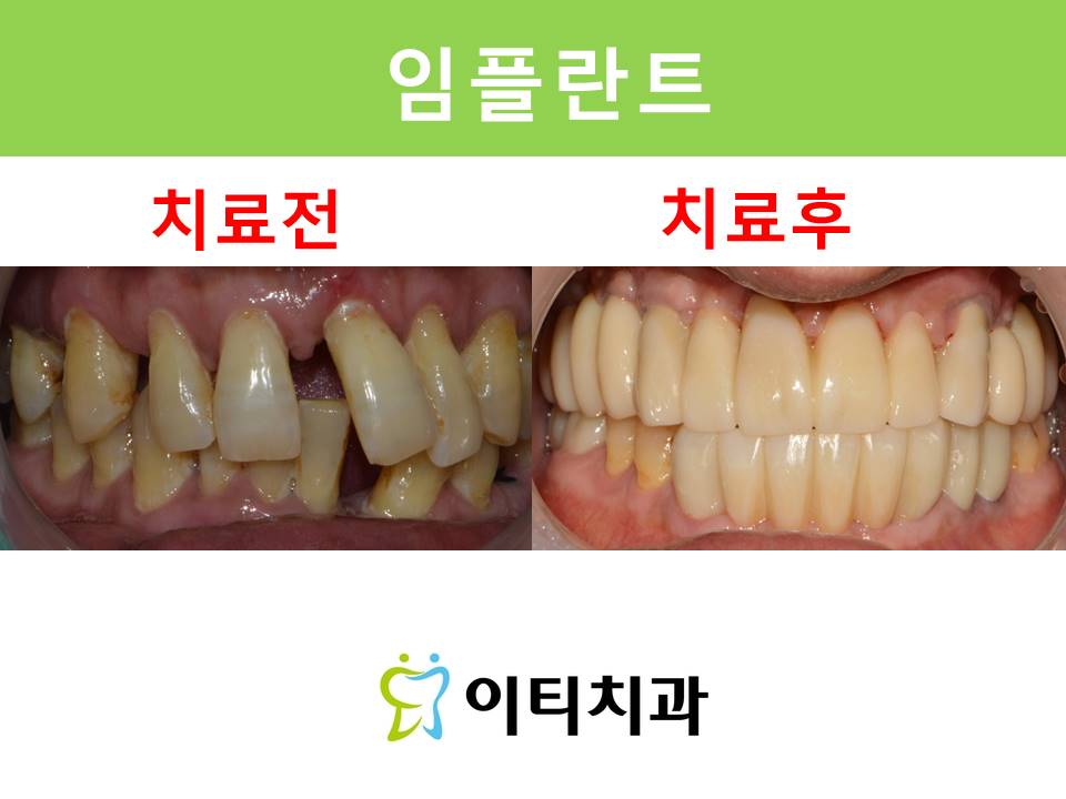 이티치과의원 대표 이미지